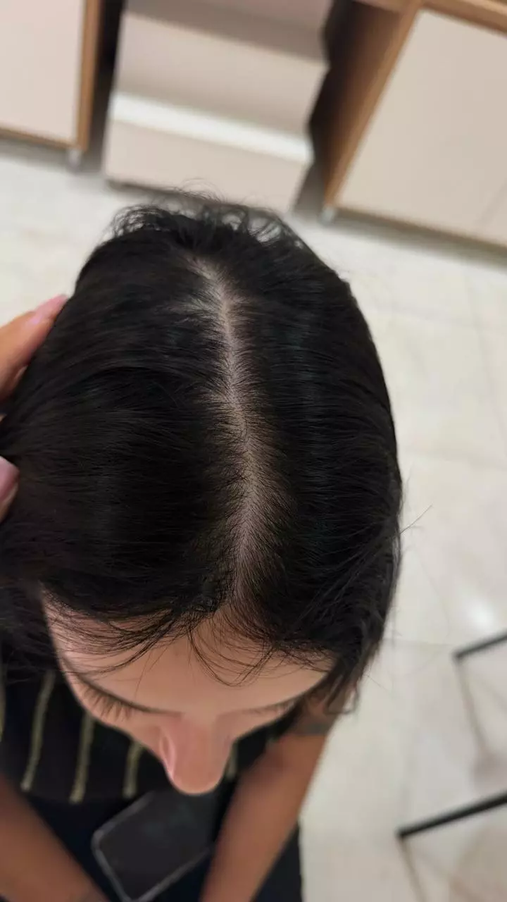 Depois do tratamento capilar